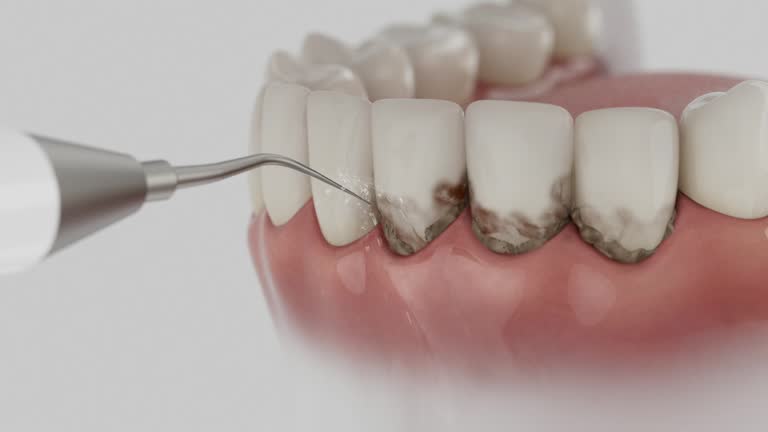 Reliable Dental Implants contractor in Fullerton, CA by Smile Center Dentistry